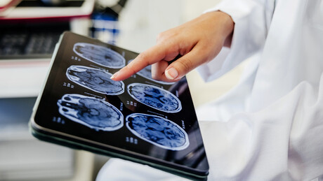Cientistas criam método para detectar risco de Alzheimer antes dos sintomas