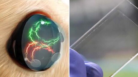 Lentes de contato com estímulos elétricos reduzem sinais de depressão em testes
