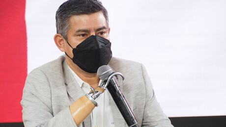 Conheça Luis Galarreta, novo vice-presidente do Peru que usa ganchos protéticos nos dois braços