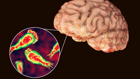 Ameba comedora de cérebro: cientistas alertam para possível expansão global