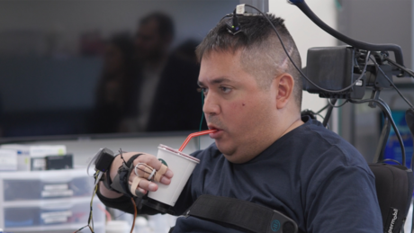 Paciente com paralisia completa recupera mobilidade nas mãos com ajuda de implante cerebral