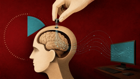 China desafia Neuralink com implante cerebral que pode ser colocado em apenas 10 minutos