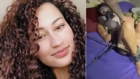 IMAGENS FORTES: Vítima mantida em cárcere pelo companheiro faz alerta a mulheres: 'No primeiro sinal, sai fora'