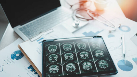 Estudo revela conexão direta entre músculos abdominais e circulação sanguínea no cérebro