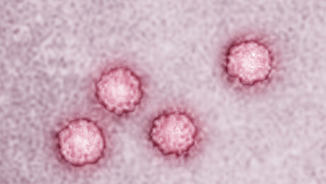 5 tipos de infecções estariam por trás de mais de 2 milhões de casos de câncer: quais são?