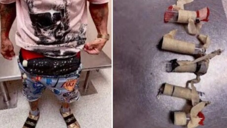 FOTOS: Homem é detido no aeroporto de Miami após autoridades notarem 'volume inexplicável' em suas calças