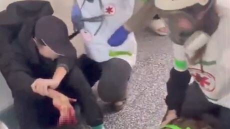 VÍDEO: Manifestante perde dedos após explosão de granada durante protesto na França
