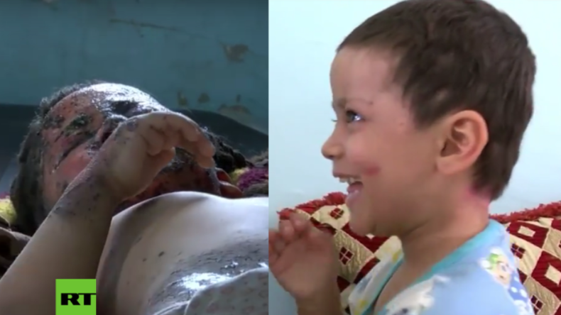 Irak: Ein Luftangriff riss ihre halbe Familie in den Tod - So geht es der kleinen Hawraa heute