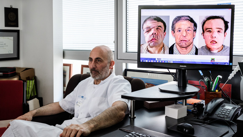 Mann mit drei Gesichtern: Franzose übersteht erfolgreich zweite Gesichtstransplantation