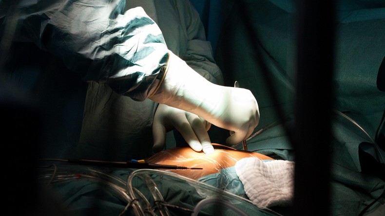 3,5 Kilo Haare im Magen: Kasachische Chirurgen retten Mädchen mit Essstörung