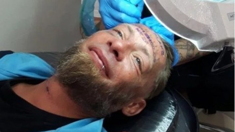 Entsetzen in Spanien: Briten bezahlen Obdachlosen für Stirn-Tattoo