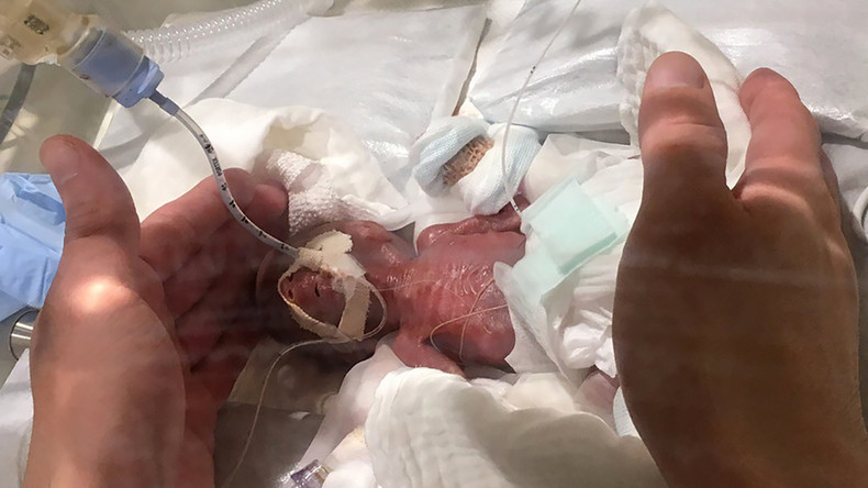 Nur 268 Gramm Geburtsgewicht: Kleinster Junge der Welt aus Krankenhaus in Tokyo entlassen