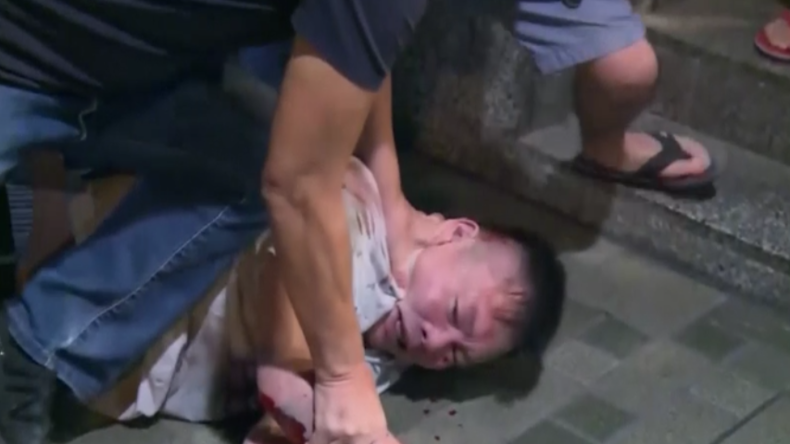 Hongkong: Mann beißt Lokalpolitiker Ohr ab und sticht auf mindestens vier Menschen ein