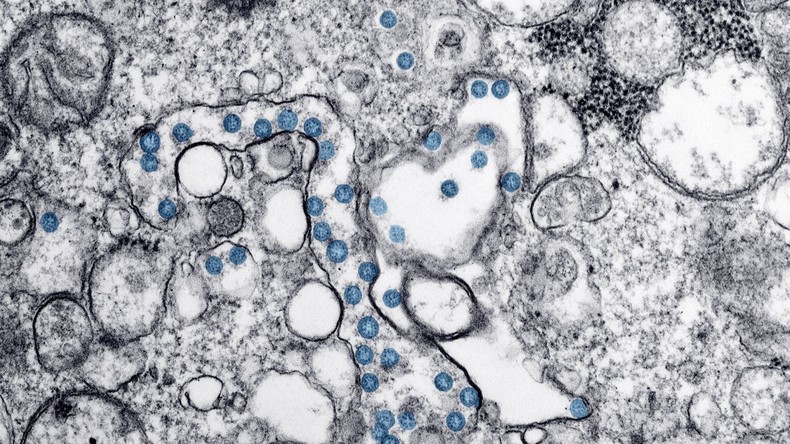 Studie: Wissenschaftler hemmen Corona-Viren beim Eindringen in Zellen