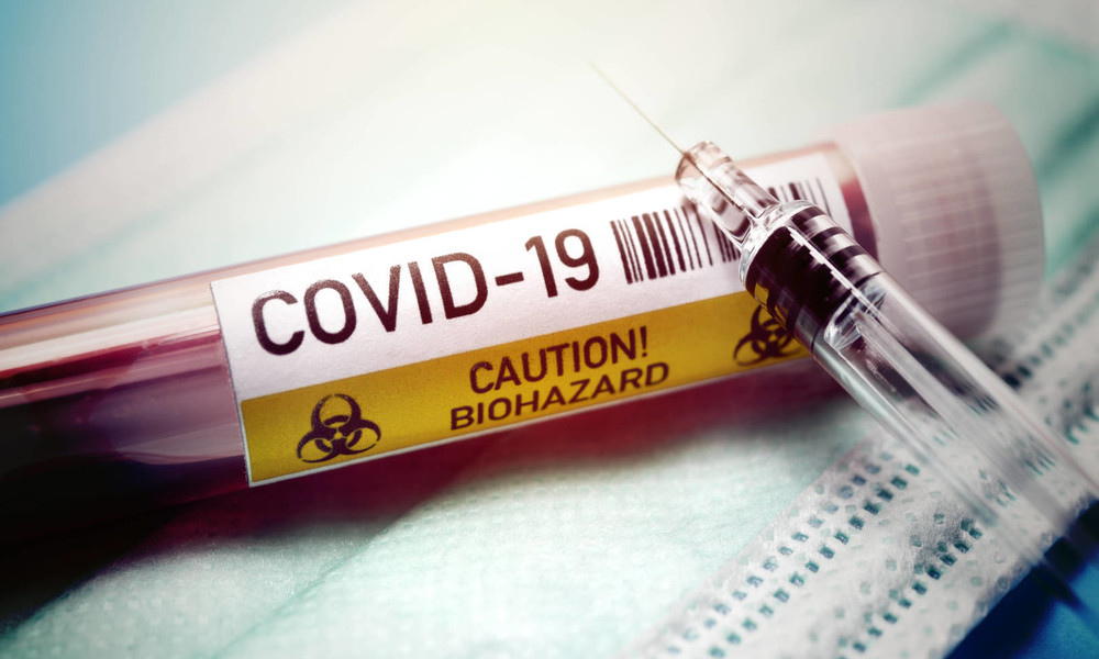 Spanischer Paukenschlag? Forscher weisen Coronavirus in Proben vom Frühjahr 2019 nach