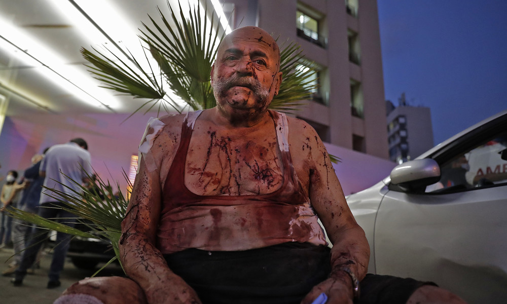 Beirut: Mindestens 50 Tote, über 2.500 Verletzte, Krankenhäuser überfordert (Video)