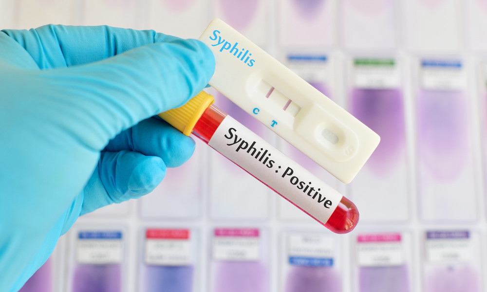 RKI: Syphilisdiagnosen in Deutschland auf Höchststand seit 2001