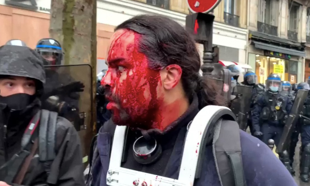 "Ist nur Schminke" – Französischer TV-Sender verharmlost Polizeigewalt gegen Demonstranten