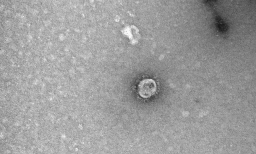 Russisches Forschungszentrum für Virologie und Biotechnologie: Coronavirus ist nicht menschengemacht