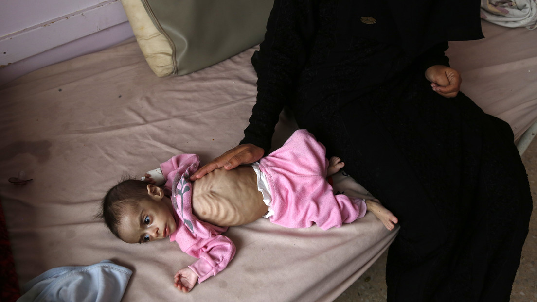 "Kinder sehen wie Skelette aus" – UN-Welternährungsprogramm über Hungersnot im Jemen
