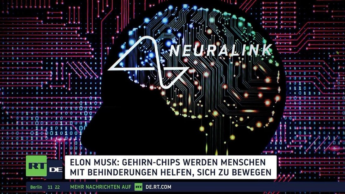 Gehirn-Chips bald Realität?