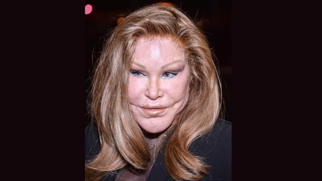 "Katzenlady" Jocelyn Wildenstein ist tot