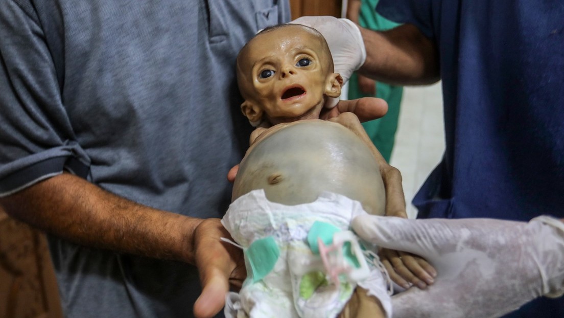 Britischer Arzt: Israel verbietet Einfuhr von Babynahrung nach Gaza und übt Schießen auf Menschen
