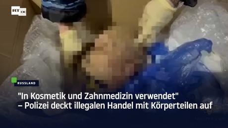 "In Kosmetik und Zahnmedizin verwendet" – Polizei deckt illegalen Handel mit Körperteilen auf