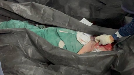 Frauenfreiheiten in Form von toten Mädchen