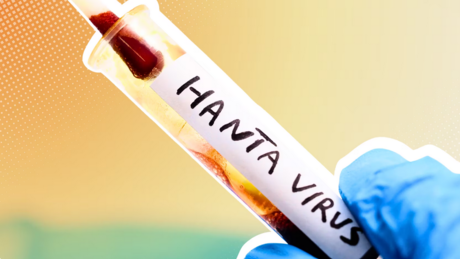 Hantavirus: Vier Kreuzfahrt-Passagiere nun in Frankfurt – RKI: "Keine Pandemiegefahr"