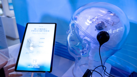 Rennen um Hirn-Implantate: Erster kommerzieller Einsatz geht an China