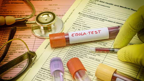Ebola-Epidemie: Russland liefert Tests nach Uganda
