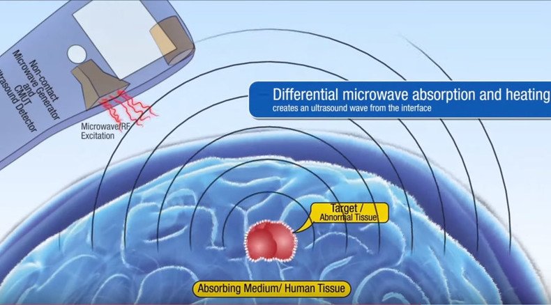 Stanford scientists test ultrasound & microwave ‘tricorder’ to detect tumors remotely