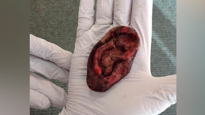 ‘Nothing to see ear’: UK Police called over fake severed ‘human’ lobe