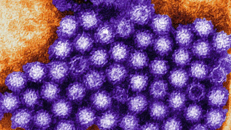 Norovirus infections spread to more college students in Michigan and Ohio