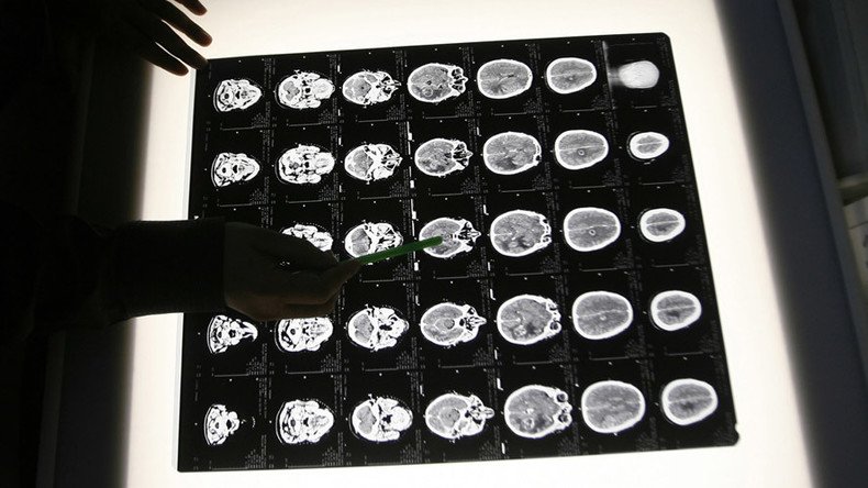 Supercharge Your Brain: Drs. John Ratey & Michael Merzenich