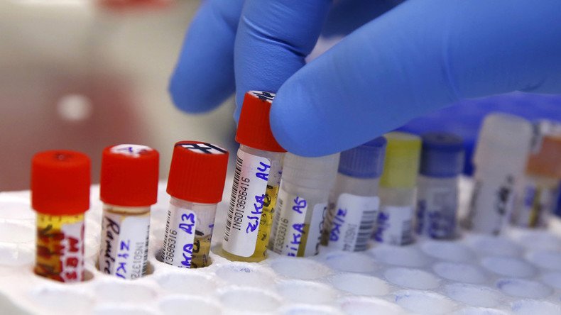 Zika may cause brain infection in adults — study