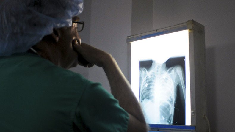 No bones about it: Yale surgeon removes wrong rib, accused of cover-up
