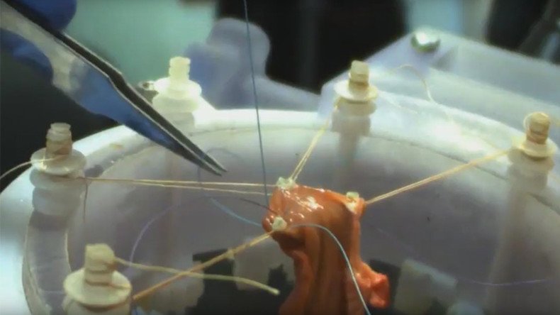Robot performs soft-tissue surgery without human operator