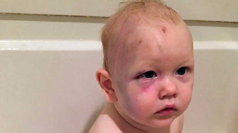 #JusticeforJacob: Massive online support for 1yo beaten by babysitter who walked free