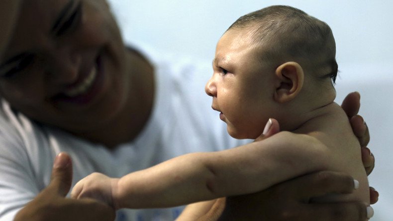 Europe’s first Zika-caused microcephaly baby born in Spain