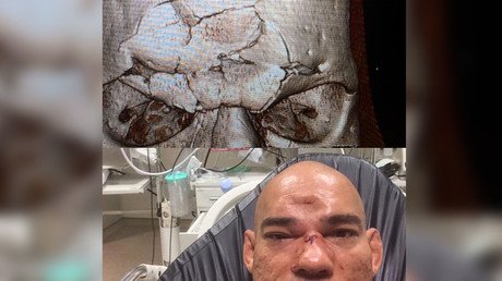 Santos suffers horrifying injury after a knee to head hit from Michael Page