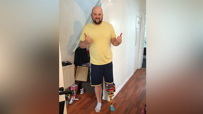 Amputee builds himself Lego leg while waiting for prosthetic limb