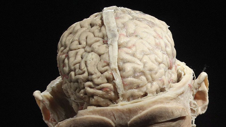 Science Museum gets a piece of visitors’ minds after male/female brain comparison