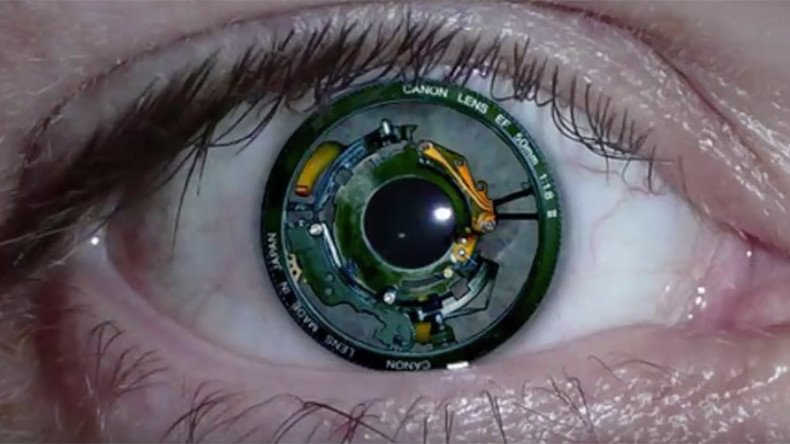 New bionic eye implant connects directly to brain, allowing blind woman to see shapes & colors