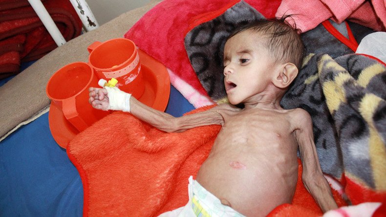#600Days of siege & genocide: Twitterstorm calls for an end to Yemen conflict