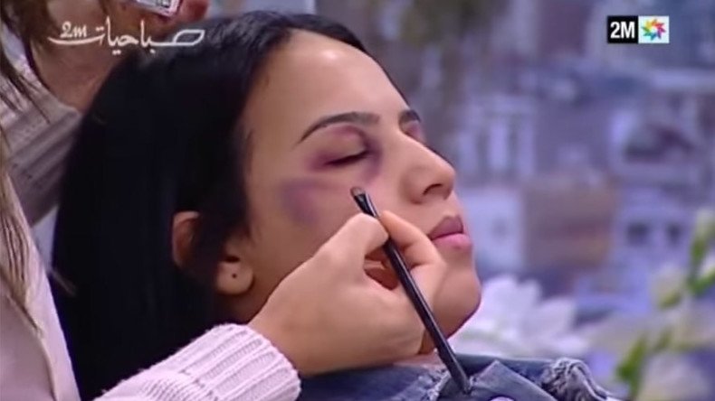 Moroccan TV show giving women tips on hiding domestic violence bruises provokes outrage