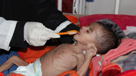 Yemenis ‘slowly starving’ to death as world ‘turns blind eye’ – aid charity