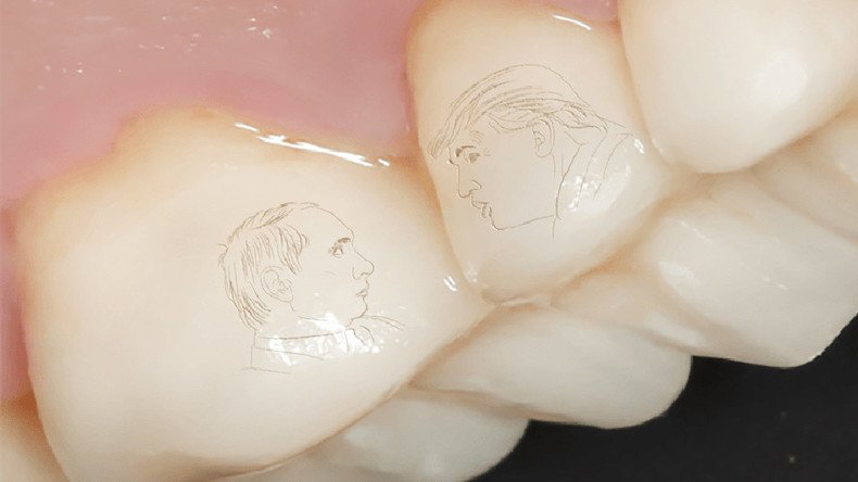 Forget gold teeth, Putin-Trump dental crowns is now a thing in Russia (PHOTOS)