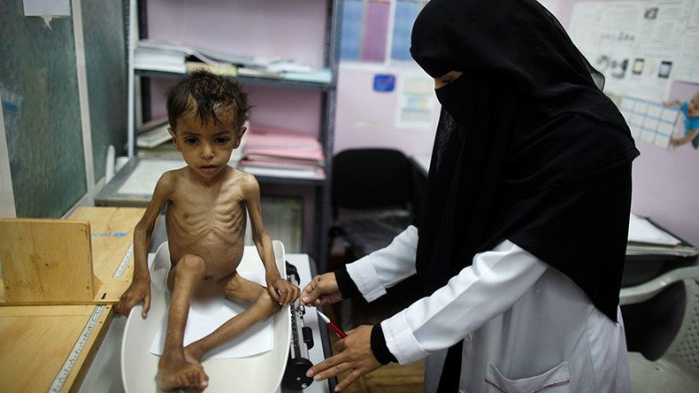 UN: Yemen could face famine in 2017, over 2/3 of population in urgent ...